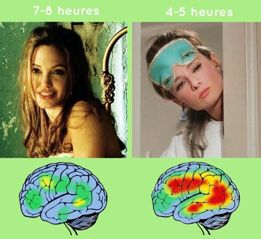 sommeil, cerveau, importance