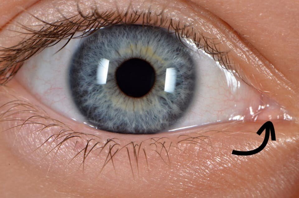 oeil, membrane, pli, semi, lunaire, humain