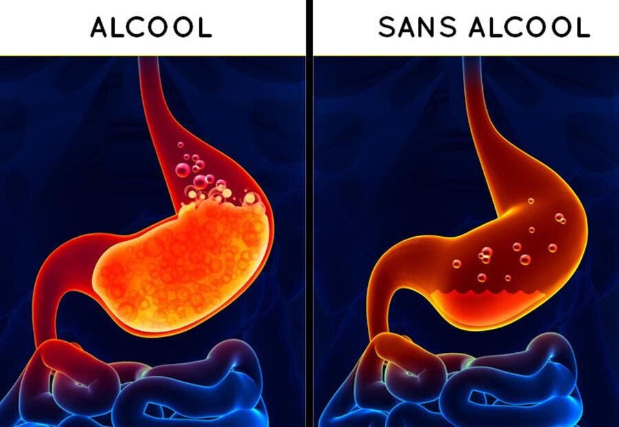 estomac, alcool, digestion