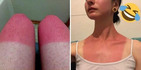 Bronzage : 10 personnes qui n'ont pas saisi l...