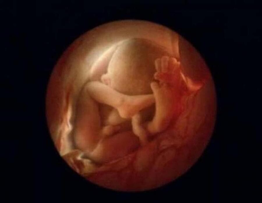 Photographie du foetus entier