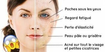 Mefait Visage Aliment